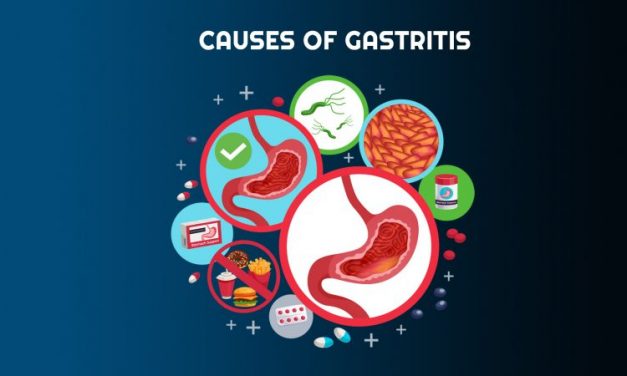 Gastritis – মূল কারণ, প্রতিকার ও আয়ুর্বেদিক ঘরোয়া চিকিৎসা